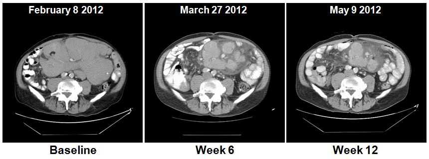 cancer-scans-jpg-data